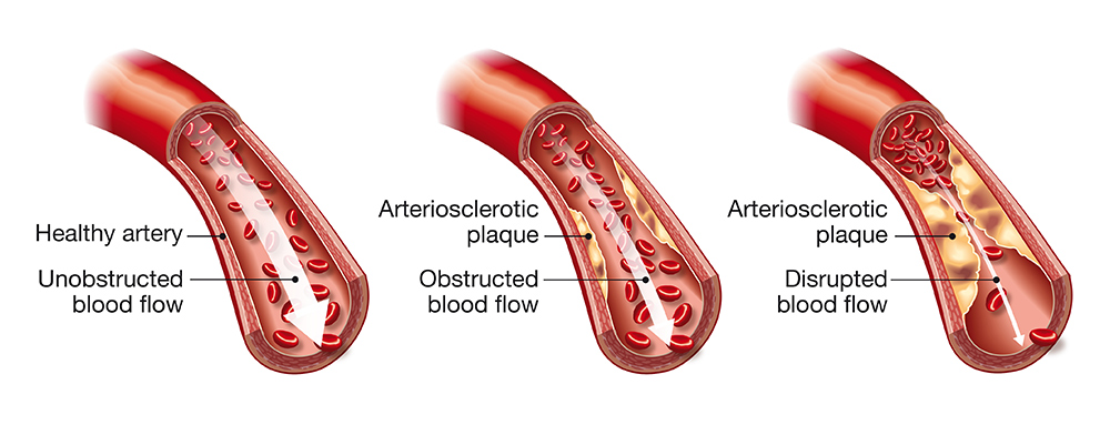 Cardiovascular - blood flow