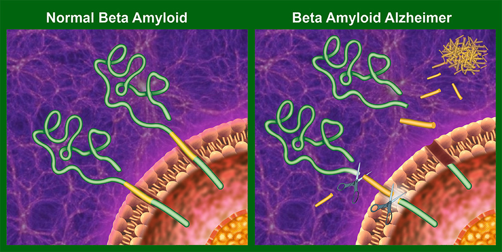 Beta-amyloid protein